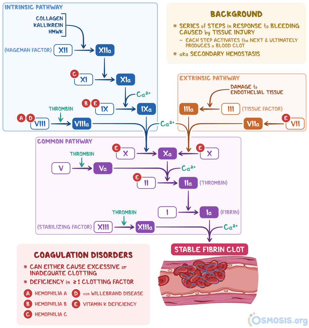 Coagulation pathway diagram. The intrinsic pathway runs factor XII to XI to IX to VIII with calcium. The extrinsic pathway runs tissue factor and factor VII. Both converge on the common pathway: factor X, with factor V, converts prothrombin (II) to thrombin (IIa), which converts fibrinogen (I) to fibrin (Ia); thrombin also activates factor XIII, which stabilizes the clot. Red letters mark factors involved in hemophilia A (VIII), hemophilia B (IX), hemophilia C (XI), von Willebrand disease (VIII) and vitamin K deficiency (II, VII, IX, X).