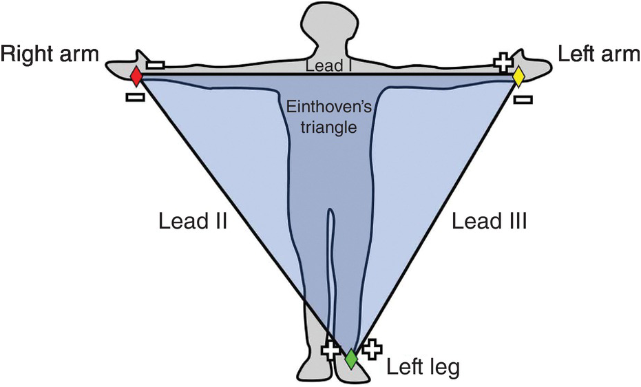 Diagram of a figure with arms outstretched showing Einthoven's triangle: lead I across the shoulders from right arm to left arm, lead II from right arm to left leg, and lead III from left arm to left leg, with positive and negative poles marked.