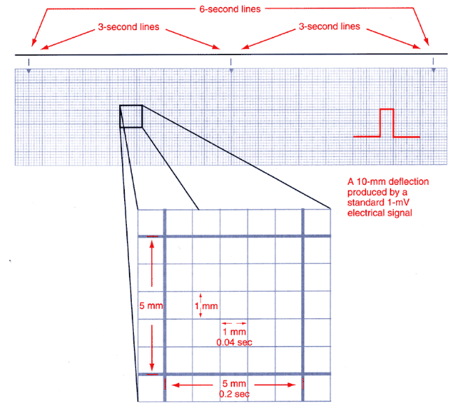 Enlarged electrocardiogram graph paper showing 3-second and 6-second marker lines along the top, one large box magnified to show 1 millimeter small boxes of 0.04 seconds and 5 millimeter large boxes of 0.2 seconds, and a red 10 millimeter calibration pulse labeled as a standard 1 millivolt signal.