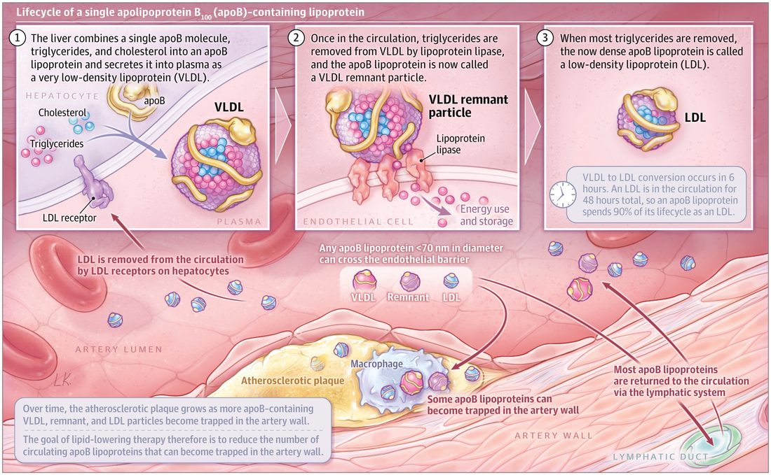 Illustration of the lifecycle of one apolipoprotein B-100 particle: the liver secretes very low-density lipoprotein, lipoprotein lipase on the endothelium strips triglycerides to leave a remnant, and the dense particle becomes LDL, which is cleared by hepatic LDL receptors. Particles under 70 nanometers cross the endothelium; most return via the lymphatics, but some are trapped in the artery wall, where macrophages take them up and plaque grows.