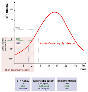 Graph of troponin concentration on a logarithmic scale against hours after acute coronary syndrome onset, with horizontal cutoff lines for 1995, 2003 and 2007 assays and a shaded low region marked high-sensitivity assays; a table beneath lists each assay's diagnostic cutoff and year.